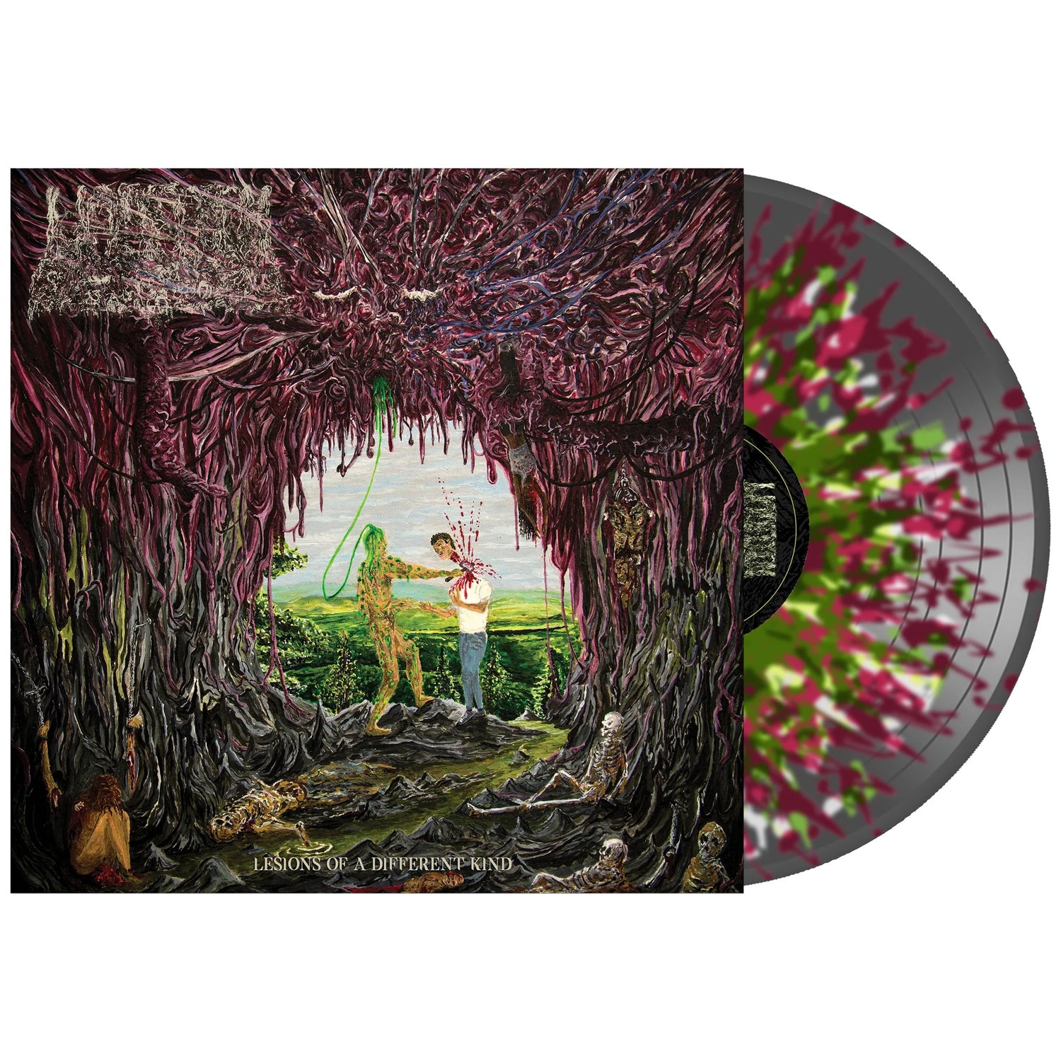 Undeath - Lesions of A Different Kind 12" LP (Clear Black w/ Maroon, Green & White Splatter Vinyl)