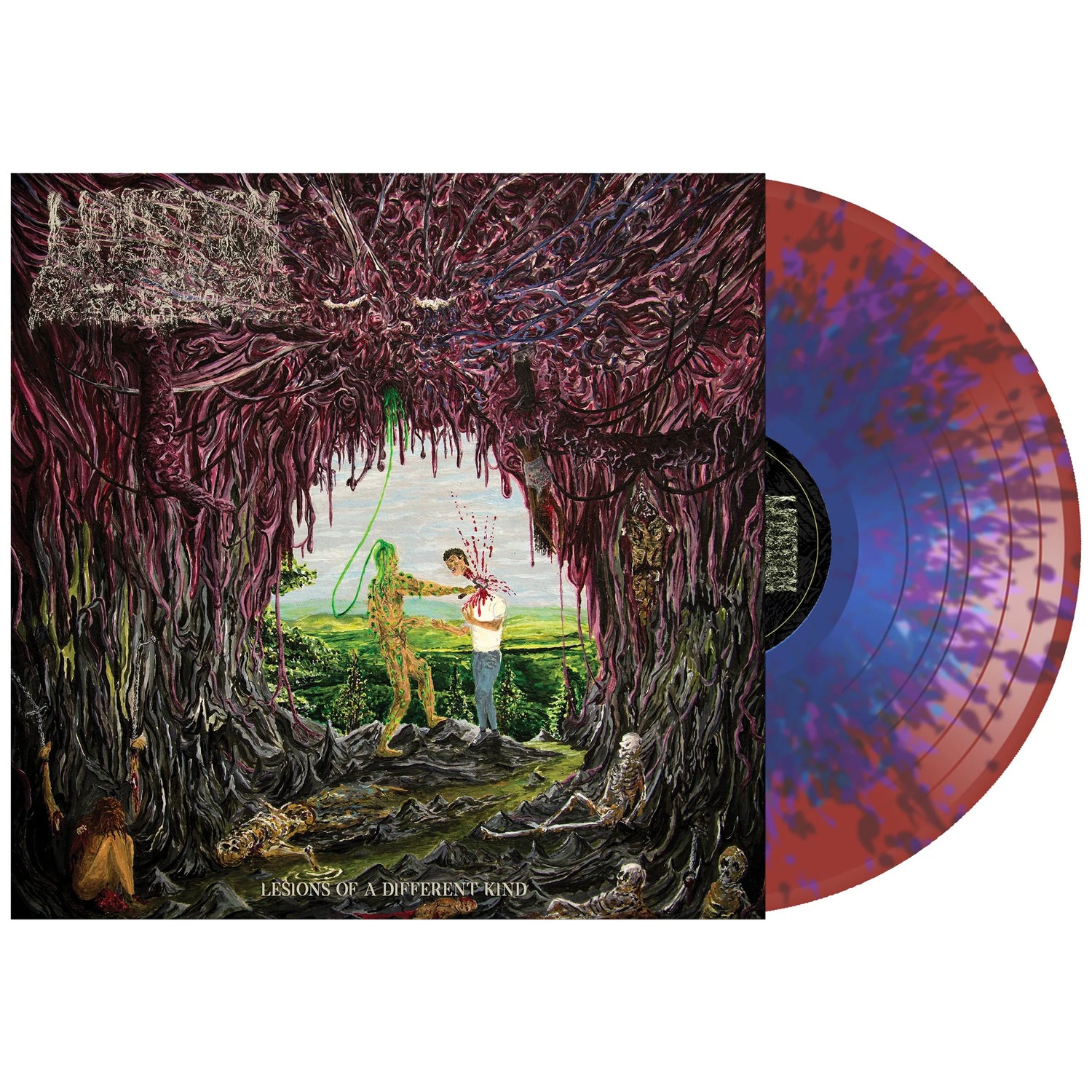 Undeath - Lesions of A Different Kind 12" LP (Clear Dark Red & Purple w/ Light Blue Splatter Vinyl)